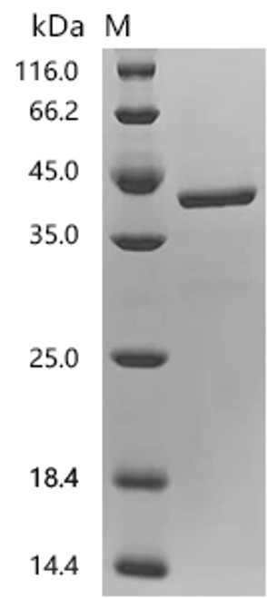 Recombinant Human Interferon-induced, double-stranded RNA-activated protein kinase (EIF2AK2), partial (CSB-YP007511HU1) Recombinant Human Interferon-induced, double-stranded RNA-activated protein kinase (EIF2AK2), partial (CSB-YP007511HU1)