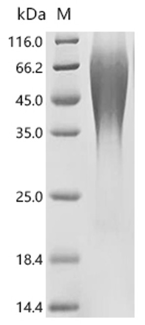 Recombinant Human Membrane-spanning 4-domains subfamily A member 12 (MS4A12), partial (CSB-YP885756HU1) Recombinant Human Membrane-spanning 4-domains subfamily A member 12 (MS4A12), partial (CSB-YP885756HU1)