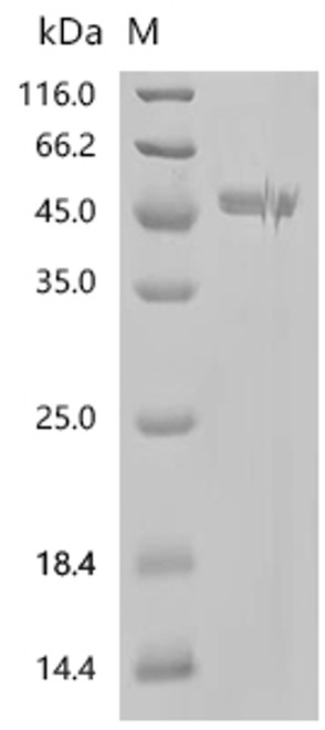 Recombinant Pig Complement C3 (C3), partial (CSB-YP003888PIa4) Recombinant Pig Complement C3 (C3), partial (CSB-YP003888PIa4)