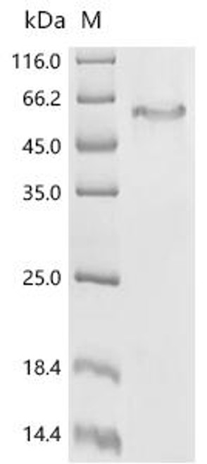 Recombinant Mycobacterium tuberculosis Probable transport accessory protein MmpS3 (mmpS3) (CSB-CF353915MVZ)