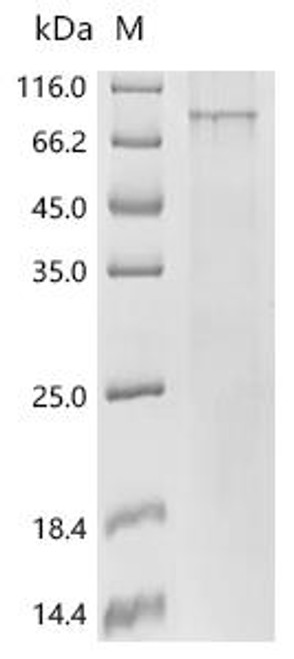 Recombinant Human Palmitoyltransferase ZDHHC14 (ZDHHC14) (CSB-CF811637HUe0)