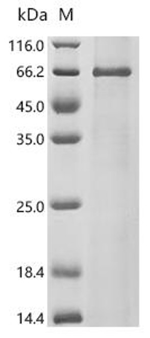 Recombinant Cocal virus Glycoprotein (G) (CSB-CF526335DUU)