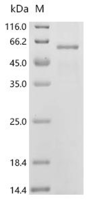 Recombinant Human Zinc transporter ZIP5 (SLC39A5) (CSB-CF747773HU)