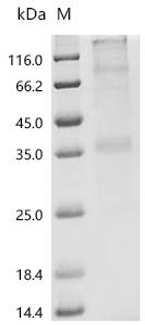 Recombinant Human Proto-oncogene Mas (MAS1) (CSB-CF013505HU)