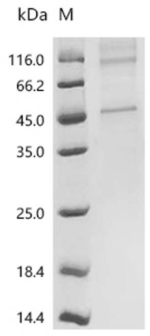 Recombinant Human Somatostatin receptor type 4 (SSTR4) (CSB-CF022727HUm3)
