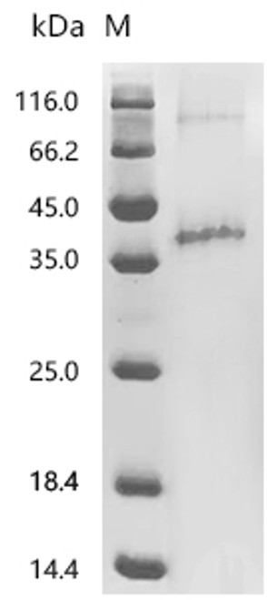 Recombinant Bovine Rhodopsin (RHO) (CSB-CF019681BOd7)