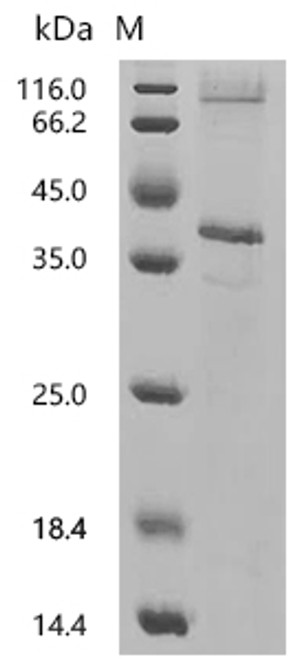 Recombinant Mouse C-C chemokine receptor type 8 (Ccr8) (CSB-CF004847MOm3)