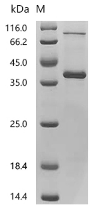 Recombinant Human Asialoglycoprotein receptor 1 (ASGR1) (CSB-CF002207HU(A4))