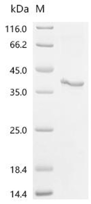 Recombinant Human STEAP1 protein (STEAP1) (CSB-CF890691HUm3)