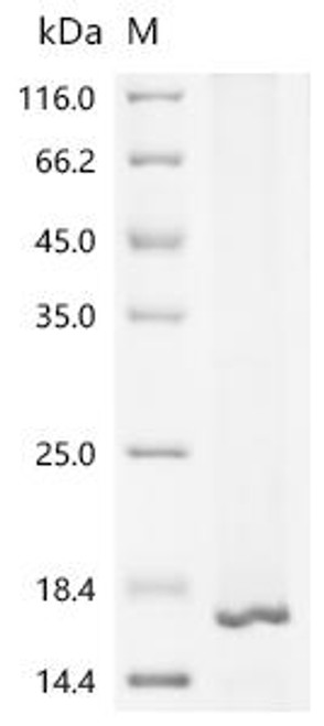 Recombinant Human Interferon-induced transmembrane protein 1 (IFITM1) (CSB-CF011024HU)