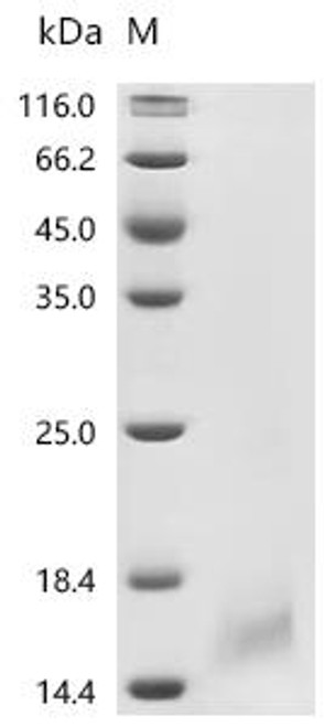 Recombinant Human coronavirus 229E Envelope small membrane protein (E) (CSB-CF322559HIT)