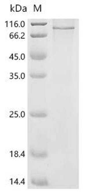 Recombinant Mouse Integrin beta-1 (Itgb1) (CSB-CF011880MO(A4))