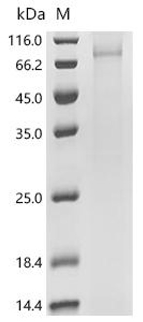 Recombinant Saccharomyces cerevisiae Putative cation exchanger YDL206W (CSB-CF615504SVG(A4))