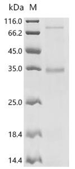 Recombinant Human Organic solute transporter subunit alpha (SLC51A) (CSB-CF768212HU)
