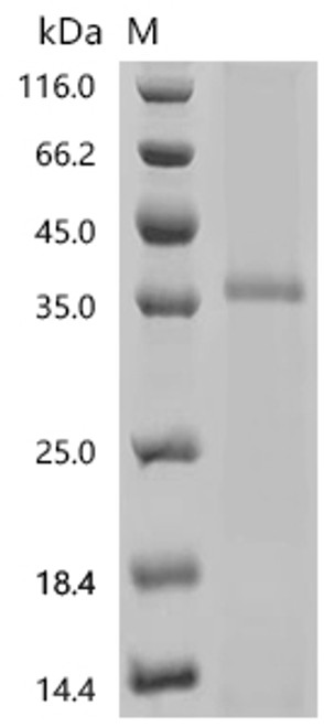 Recombinant Mouse Membrane protein MLC1 (Mlc1) (CSB-CF837739MO(A4))