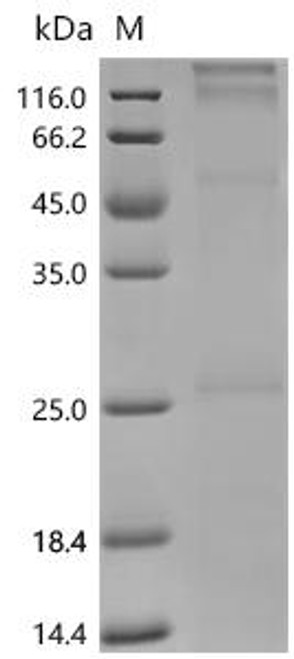 Recombinant Human Clarin-1 (CLRN1) (CSB-CF005583HU)