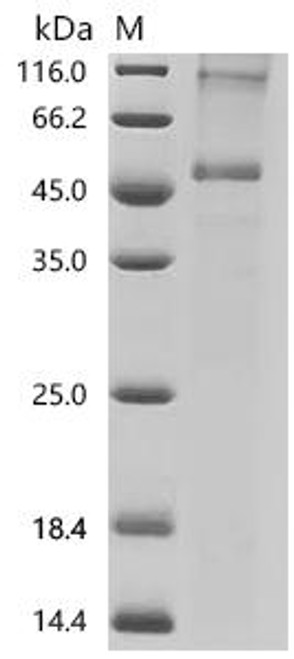 Recombinant Human Orexin/Hypocretin receptor type 1 (HCRTR1) (CSB-CF010231HU)