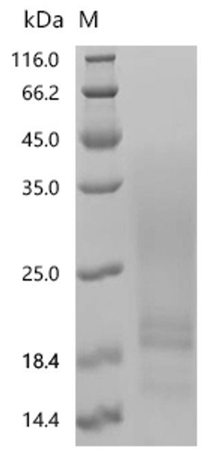 Recombinant Artemisia vulgaris Art v 2 allergen (art v 2) (CSB-YP6719A0H)