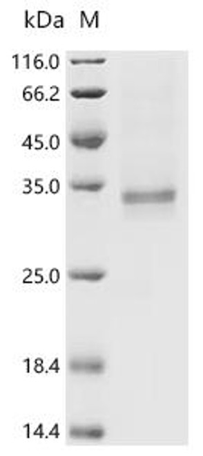 Recombinant Rat Vascular endothelial growth factor D (Vegfd) (CSB-YP008674RA)