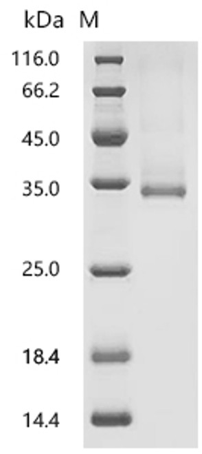 Recombinant Rat Vascular endothelial growth factor D (Vegfd) (CSB-YP008674RAc9)