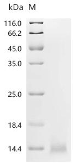 Recombinant Human Coagulation factor IX (F9), partial (CSB-YP007936HU2)
