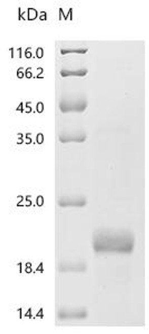 Recombinant Human Coagulation factor IX (F9), partial (CSB-EP007936HU2)