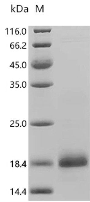 Recombinant Human Coagulation factor IX (F9), partial (CSB-EP007936HU3)