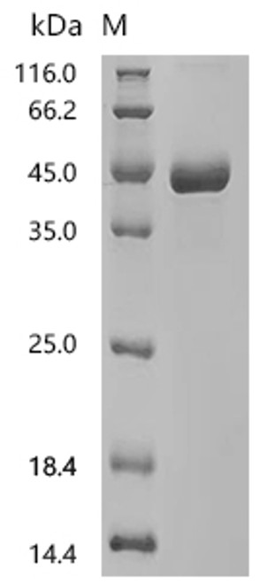 Recombinant Human Coagulation factor IX (F9), partial (CSB-MP007936HU2d9)