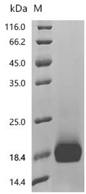 Recombinant Human Coagulation factor IX (F9), partial (CSB-MP007936HU2)