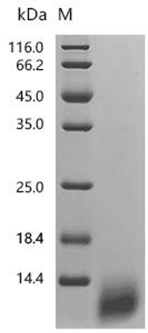 Recombinant Human Coagulation factor IX (F9), partial (CSB-MP007936HU3)