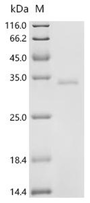Recombinant Pig Complement C3 (C3), partial (CSB-YP003888PI)