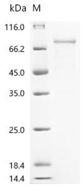 Recombinant Plasmodium falciparum Circumsporozoite protein (CSP), partial (CSB-YP362383PMI)
