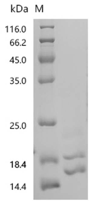 Recombinant Rat Tumor necrosis factor (Tnf), partial (CSB-YP325438RA)
