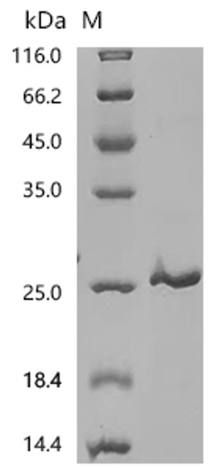 Recombinant Rat Interleukin-2 (Il2) (CSB-EP011629RA)