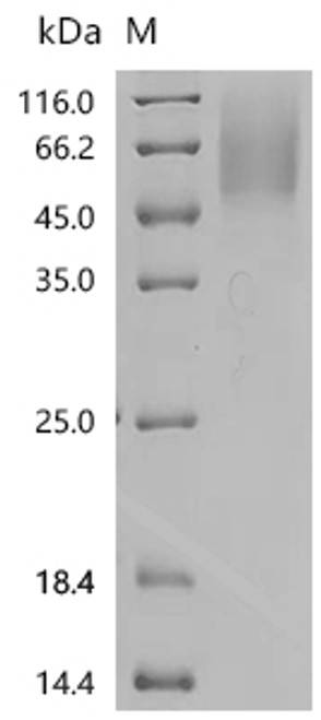Recombinant Human V-type proton ATPase subunit C 1 (ATP6V1C1) (CSB-YP002399HU)