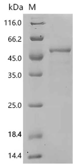 Recombinant Human V-type proton ATPase subunit C 1 (ATP6V1C1) (CSB-EP002399HU)