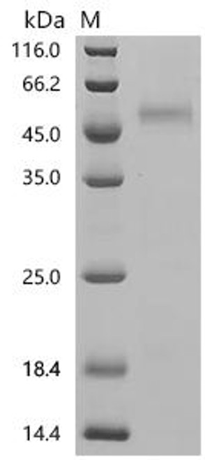 Recombinant Human V-type proton ATPase subunit C 1 (ATP6V1C1) (CSB-MP002399HU)
