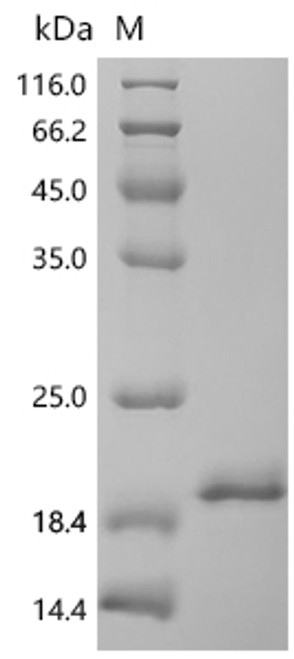 Recombinant Macaca fascicularis Interleukin-1 beta (IL1B) (CSB-YP011614MOV)