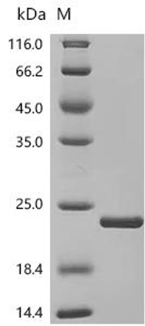 Recombinant Macaca fascicularis Interleukin-1 beta (IL1B) (CSB-EP011614MOV)