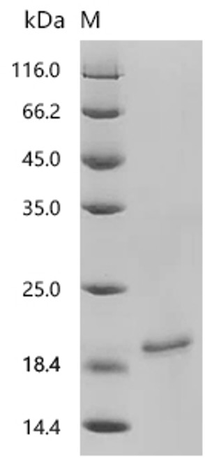 Recombinant Mouse Non-selective voltage-gated ion channel VDAC2 (Vdac2), partial (CSB-YP723359MO)