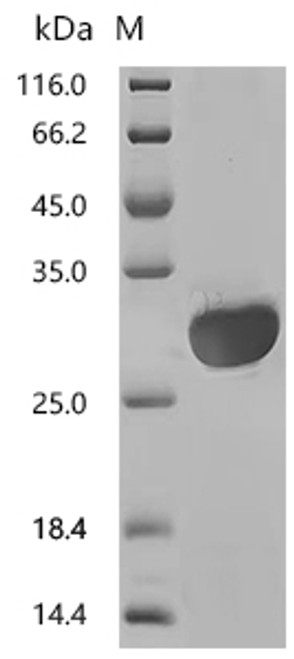 Recombinant Human Myocilin (MYOC), partial (CSB-YP859950HU1)