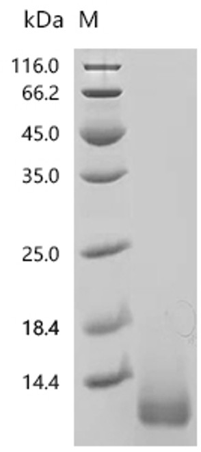 Recombinant Mouse Resistin (Retn) (CSB-YP019573MO)