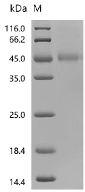 Recombinant Human Galectin-9 (LGALS9), partial (CSB-MP012895HU1b0)