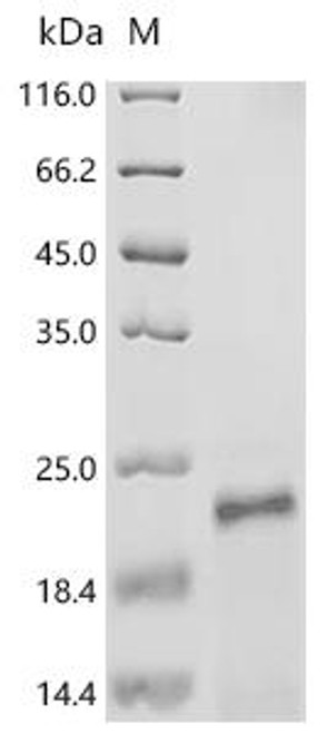 Recombinant Human papillomavirus 69 Protein E7 (E7) (CSB-EP864306HOL)