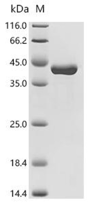 Recombinant Listeria monocytogenes serovar 1/2a Internalin B (inlB), partial (CSB-EP326188LPY)