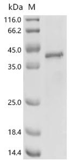 Recombinant Human Ribonuclease H1 (RNASEH1) (D210N) (CSB-EP019801HU(M))