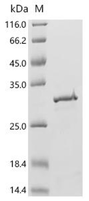 Recombinant Epstein-Barr virus Capsid scaffolding protein, partial (CSB-EP360995EFA)