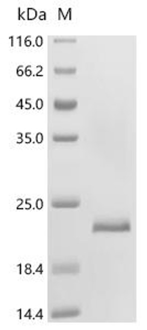 Recombinant Notechis scutatus scutatus Basic phospholipase A2 notechis II-5 (CSB-EP018091NHT)