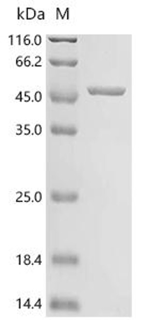 Recombinant Human GDP-mannose 4,6 dehydratase (GMDS), partial (CSB-EP009569HU1)