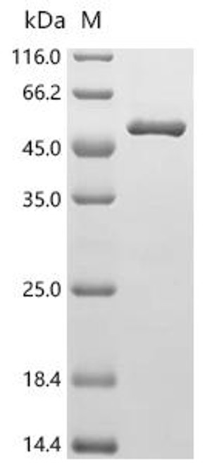 Recombinant Human Medium-chain specific acyl-CoA dehydrogenase, mitochondrial (ACADM) (CSB-EP001126HUc7)